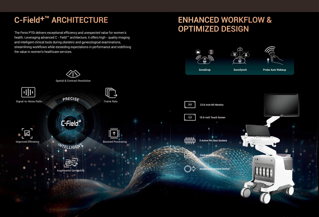 SONOSCAPE FENIX P70i